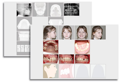 X-RAY image tool/Photo image tool