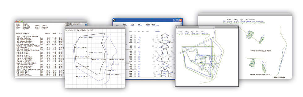 Display Measurement Value,Facial Diagram,Polygon,Superimpose